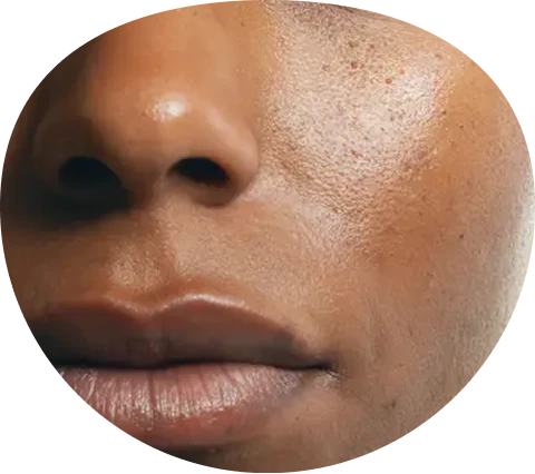 Pores and texture closeup