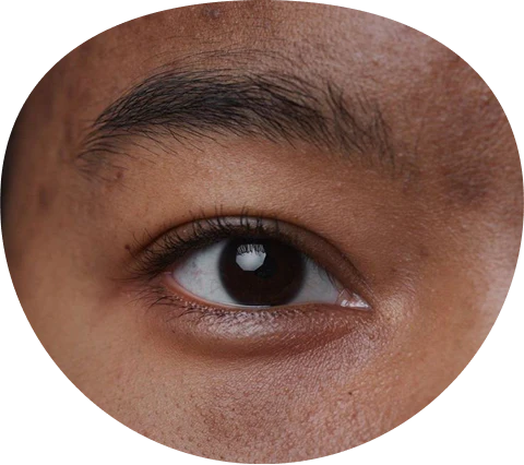 Dark circles closeup